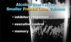 DRINKING GAMES, ALCOHOL ABUSE AND OVERDOSE